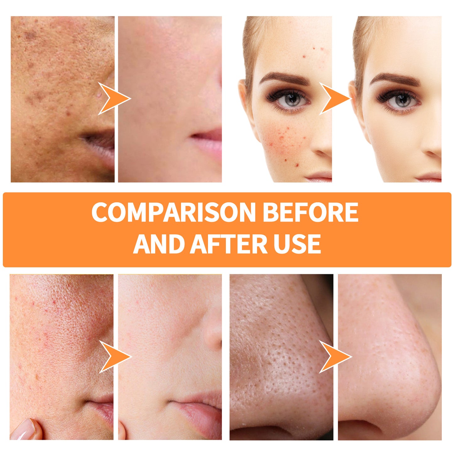 Turmeric Facial Mask